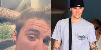 Justin Bieber walczy z chorobą! Jaka jest diagnoza?