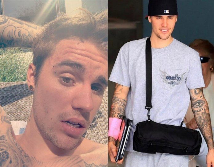 Justin Bieber walczy z chorobą! Jaka jest diagnoza?