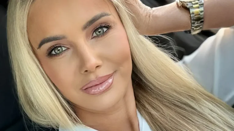 Monika Chwajoł po operacji wraca do sił. Gwiazda disco polo ujawnia kulisy trudnych chwil: „Organizm musi się nauczyć żyć na nowo”