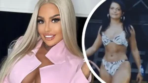 Jak wyglądała Laluna zanim zaczęła operacje?