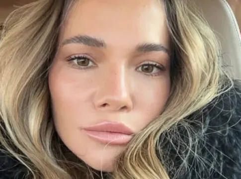 Maja Bohosiewicz bez tajemnic. Lista zabiegów zaskakuje