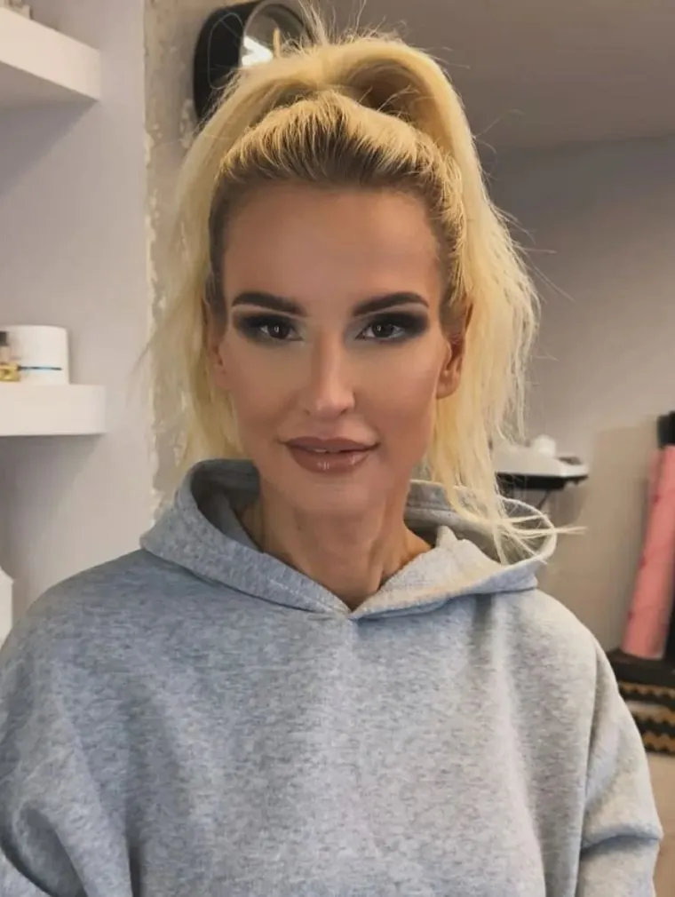 Dominika Tajner pokazała brzuch trzy miesiące po operacji plastycznej