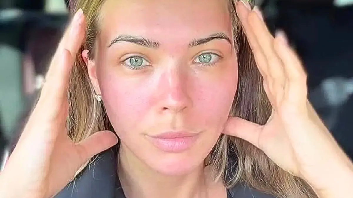 Sandra Kubicka zapowiedziała operację plastyczną