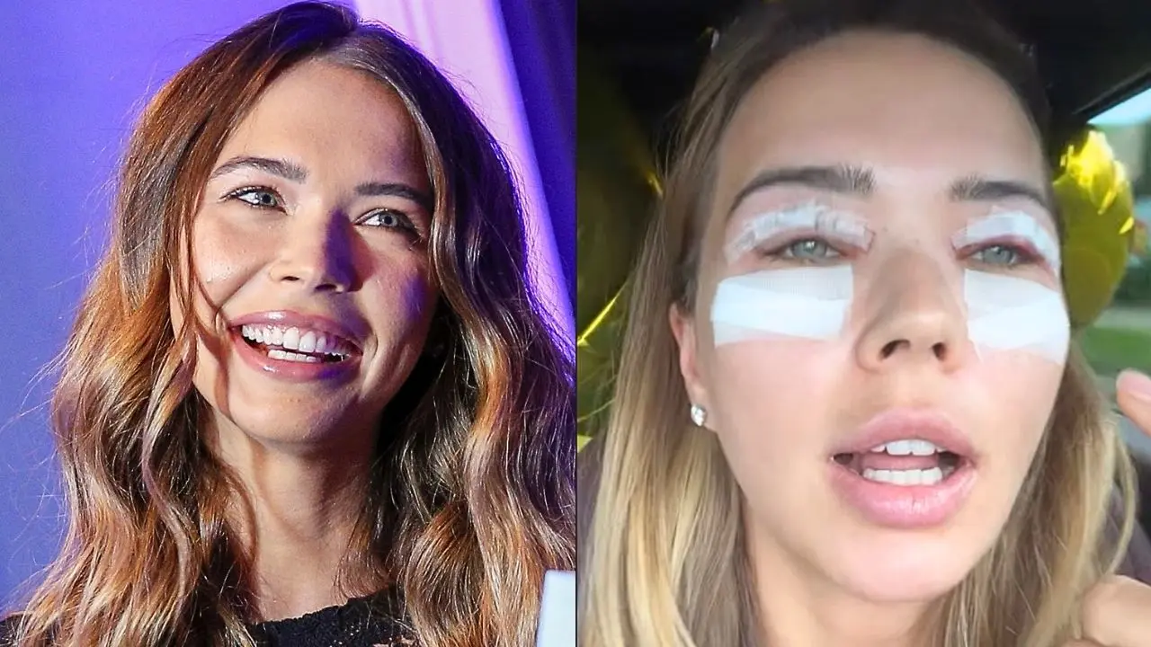 Sandra Kubicka trzy dni po operacji